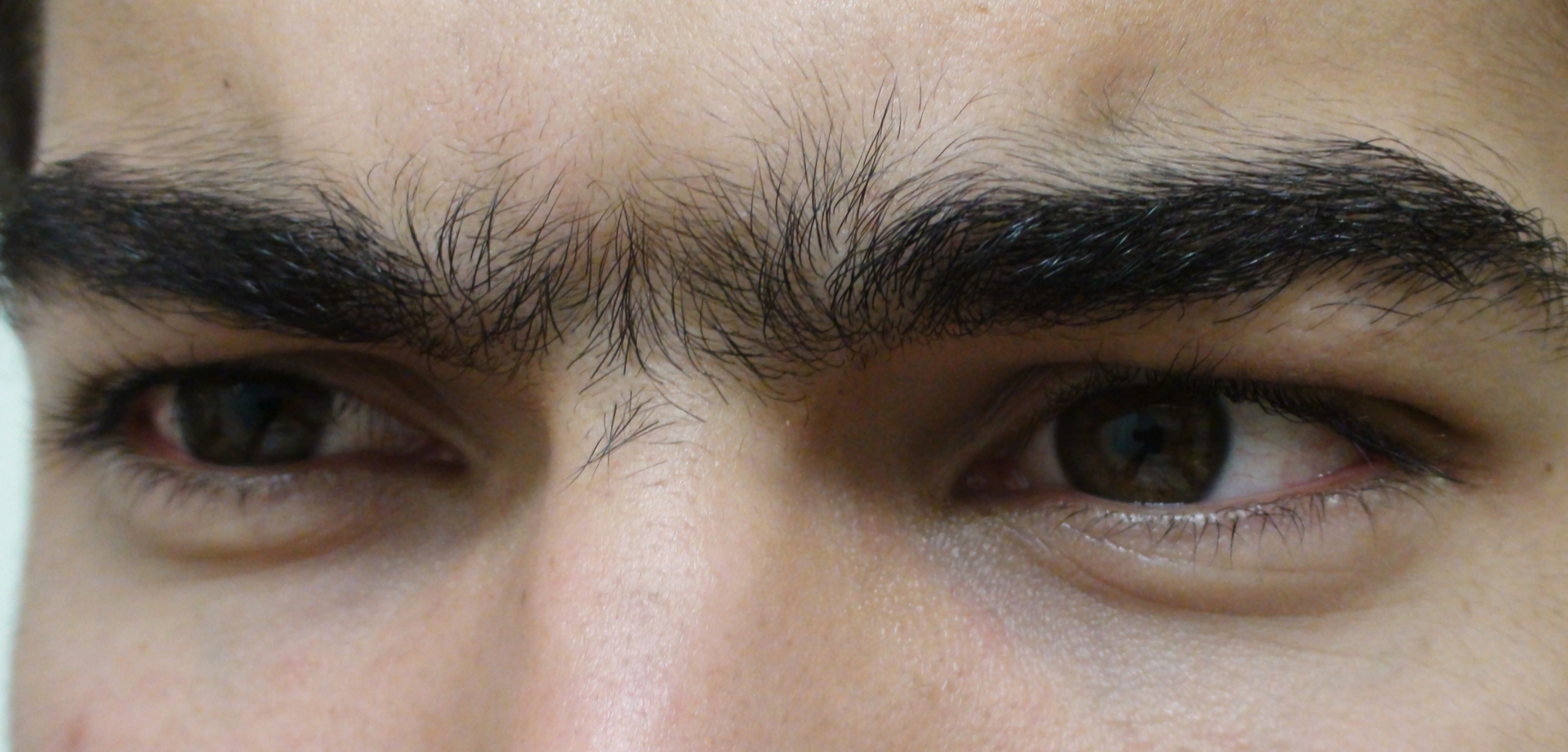 1000232500.webp