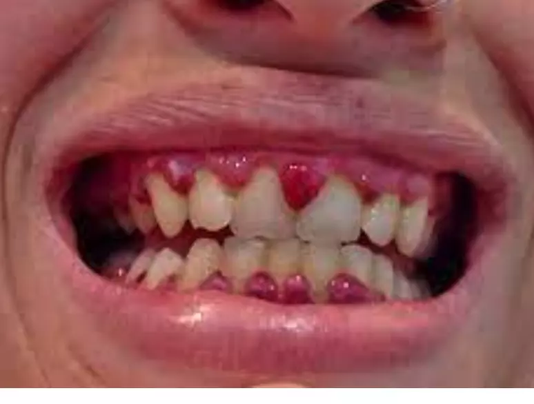 1686943419969.webp