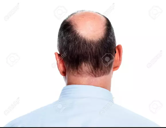 1691066956503.webp