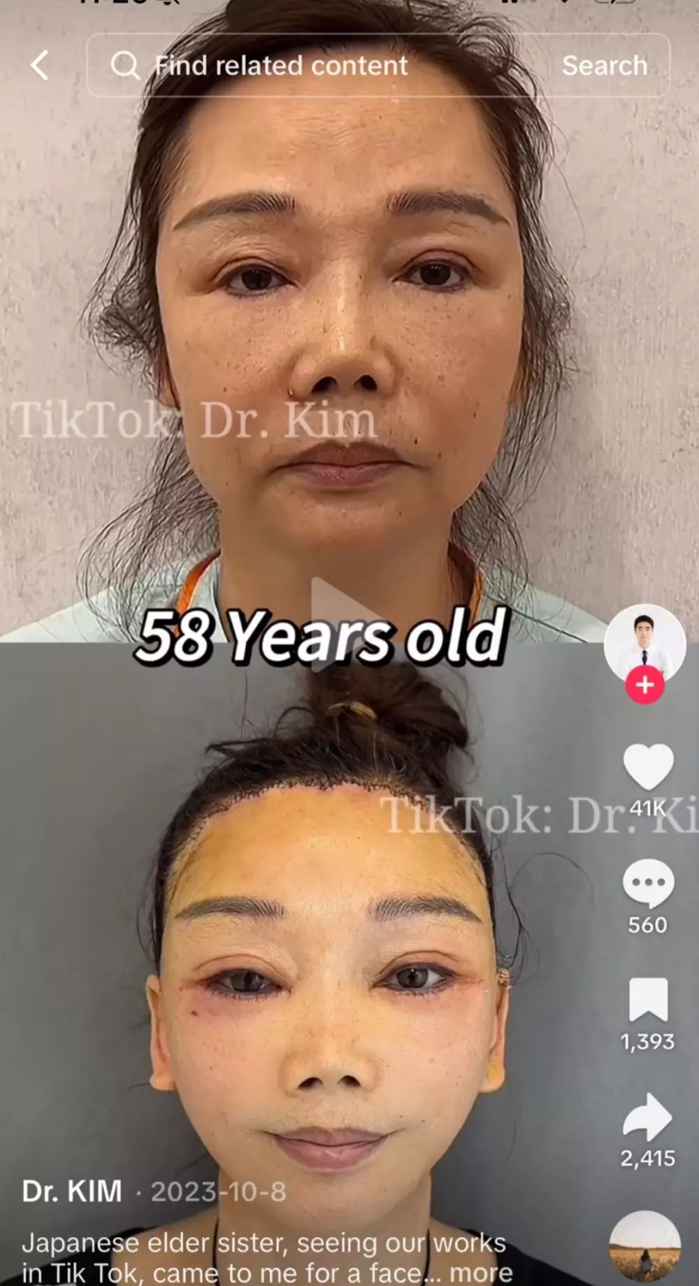 1705760784732.webp