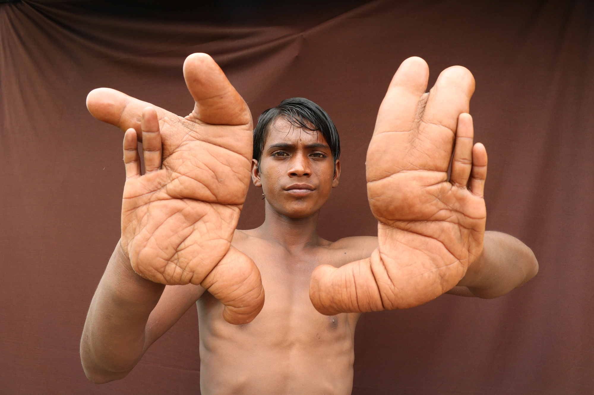 170811-indian-boy-hands-01.webp