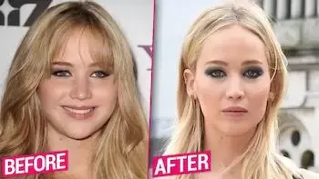 1756551794770.webp