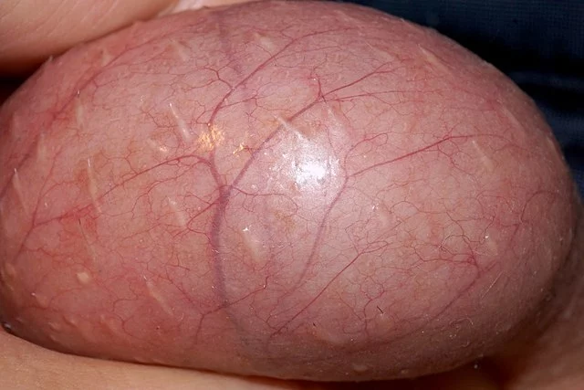 A_close-up_of_a_human_testicle.webp
