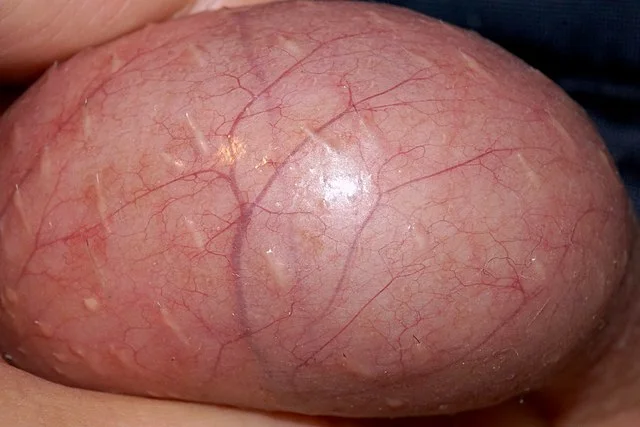 A_close-up_of_a_human_testicle.webp