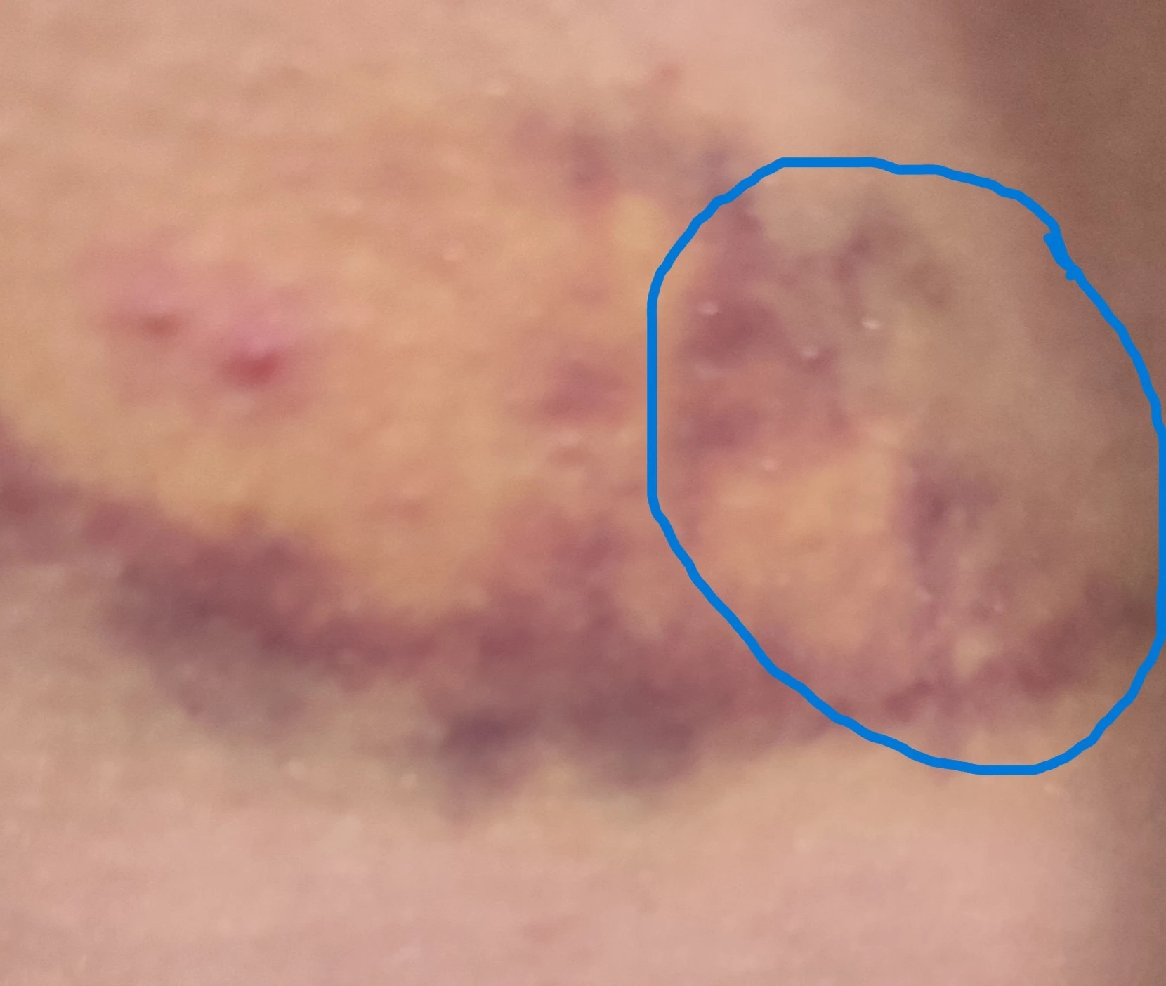 balacera.webp