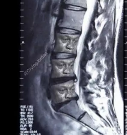 esquena mal columna negre plora.webp