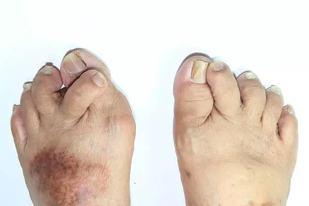 istockphoto-486566698-612x612.webp