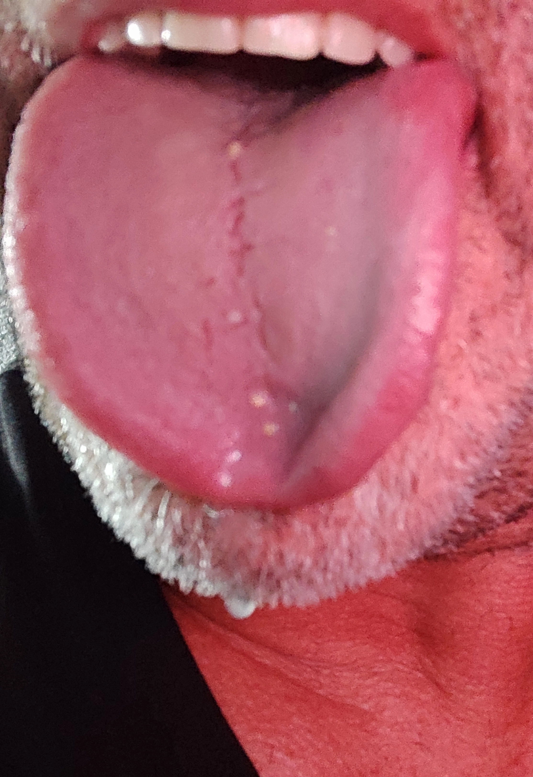 lengua.webp