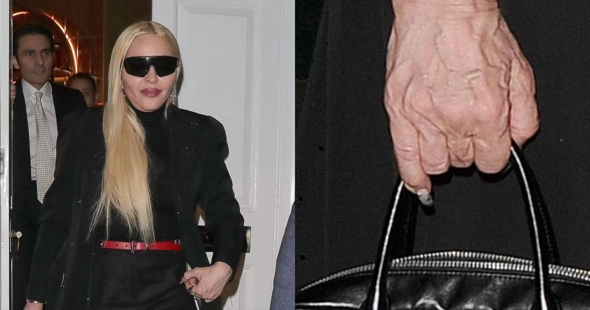 madonna-manos-edad-redes.webp