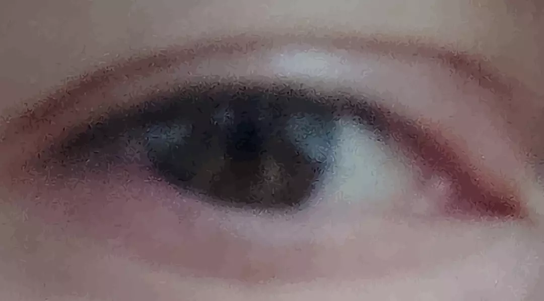 ojo.webp