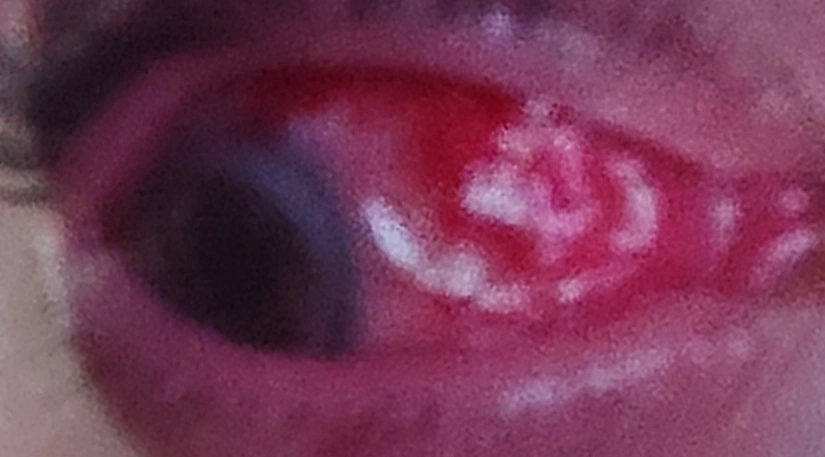 ojo2.webp