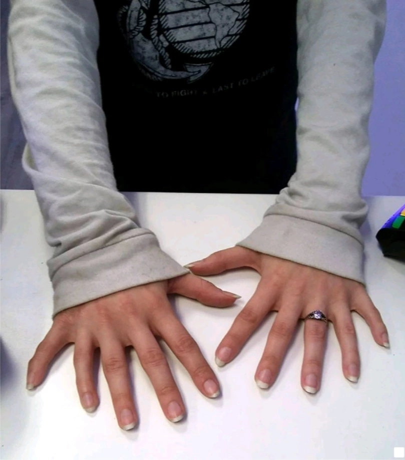 Seis dedos.webp
