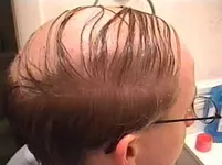comb-over.webp